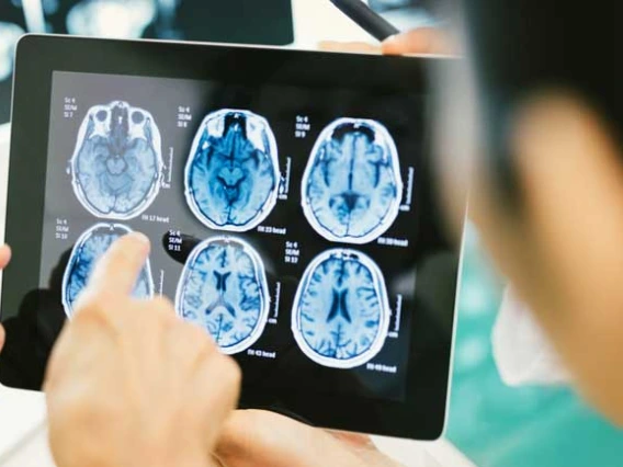 hands pointing at brain scans on tablet