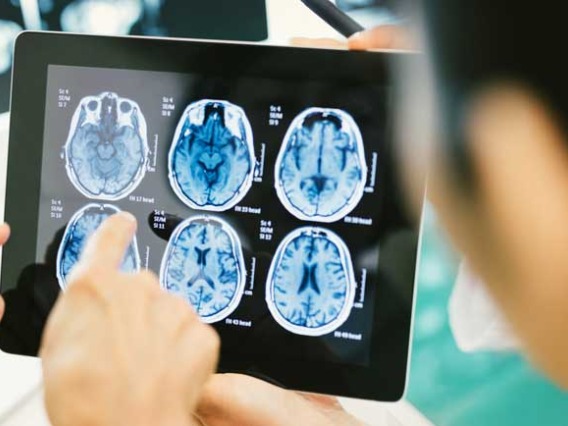 hands pointing at brain scans on tablet