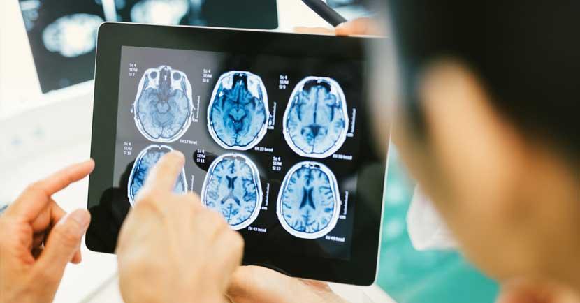 hands pointing at brain scans on tablet